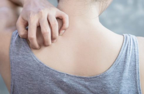 Alles wat je moet weten over rug acne en hoe je er van af komt